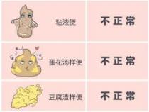 婴儿大便颜色常识图解：如何通过颜色判断宝宝健康状况