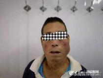 马德龙病：一种难以抑制的疾病与治疗方法